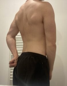 dos musclé